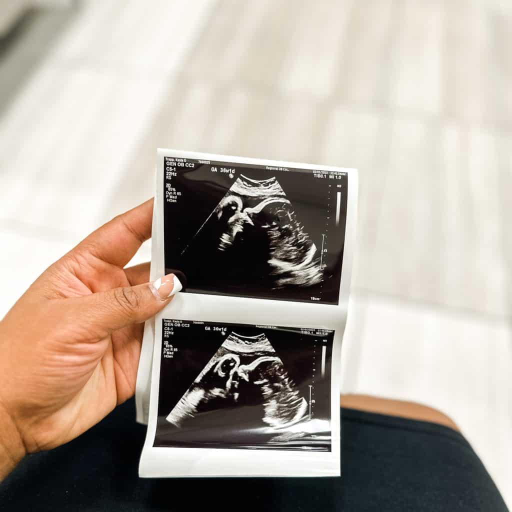 36 Week Pregnancy Update